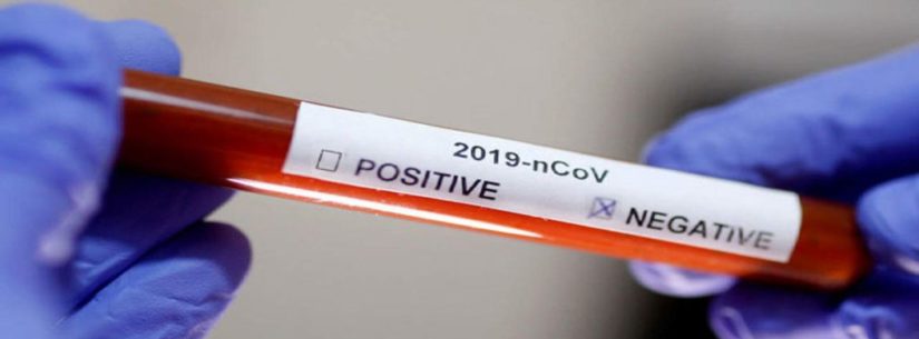 Covid-19: Casos positivos sobem 54,5% em uma semana em Caraguatatuba