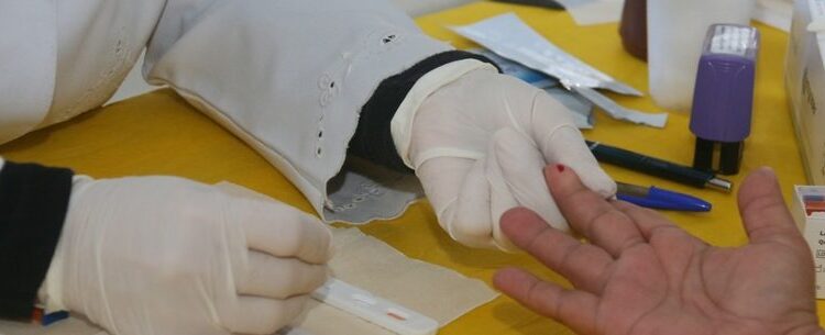 UAMI de Caraguatatuba promove ação combate à sífilis neste sábado na Praça Cândido Motta