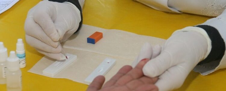 ‘Dezembro Vermelho’: Caraguatatuba inicia campanha focada na prevenção ao HIV/Aids