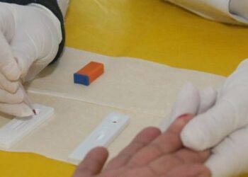 Unidades de saúde iniciam Campanha ‘Fique Sabendo’ e ofertam testes rápidos de sífilis e HIV