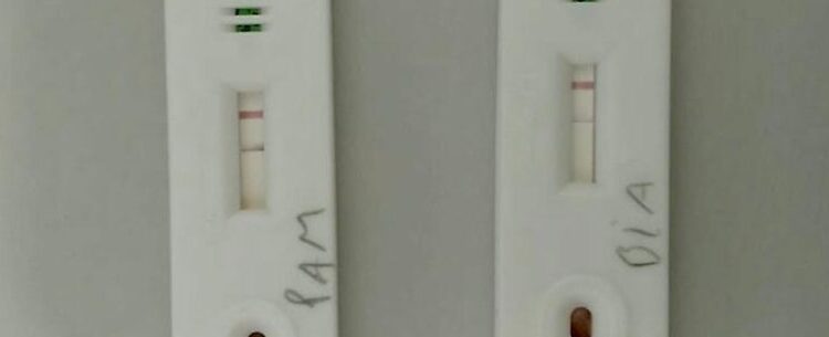 Prefeitura de Caraguatatuba inicia testagem em massa para Covid-19 a partir desta quarta-feira