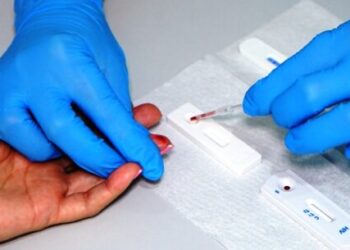 UAMI de Caraguatatuba realiza 288 testes rápidos no ‘Julho Amarelo’ e capacita profissionais de saúde nesta semana