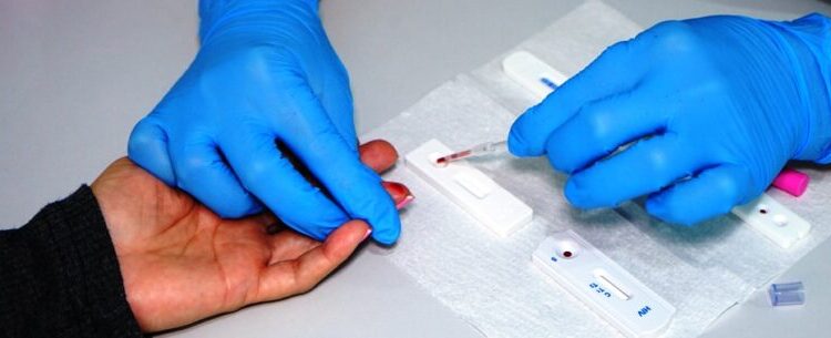 UAMI de Caraguatatuba realiza 288 testes rápidos no ‘Julho Amarelo’ e capacita profissionais de saúde nesta semana