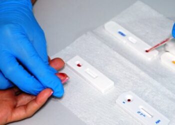 Prefeitura de Caraguatatuba leva teste rápido de HIV, Hepatites e Sífilis ao AME nesta quinta-feira