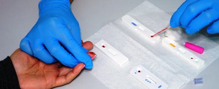 Prefeitura de Caraguatatuba leva teste rápido de HIV, Hepatites e Sífilis ao AME nesta quinta-feira