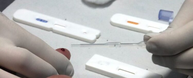 Caraguatatuba realiza mutirão para diagnóstico das Hepatites B e C neste sábado