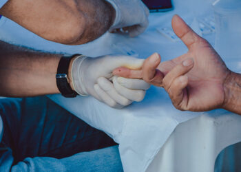 Testes de hepatites virais são intensificados durante o Julho Amarelo, em Bertioga