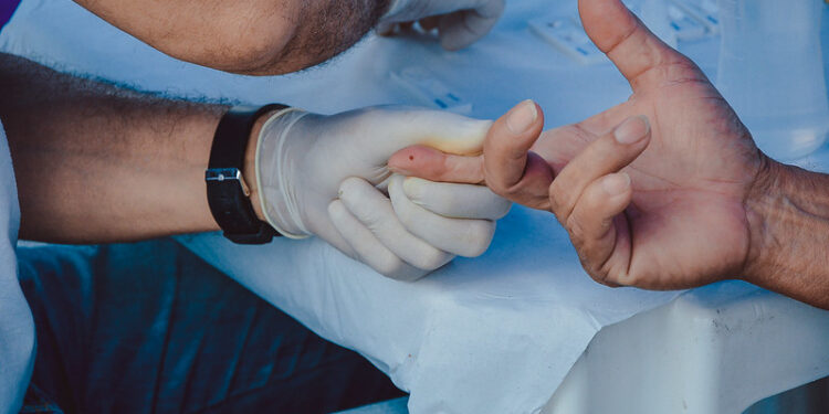 Testes de hepatites virais são intensificados durante o Julho Amarelo, em Bertioga