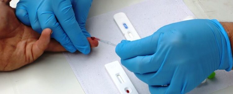 Caraguatatuba inicia Campanha ‘Dezembro Vermelho’ com teste rápido para população neste sábado