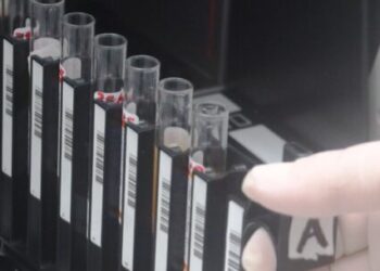 Prefeitura de Caraguatatuba conta com novo e moderno equipamento para exames de sorologia