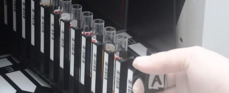 Prefeitura de Caraguatatuba conta com novo e moderno equipamento para exames de sorologia