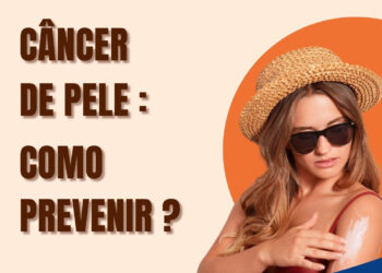 Câncer de Pele: Fique atento e previna-se!