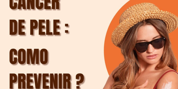 Câncer de Pele: Fique atento e previna-se!