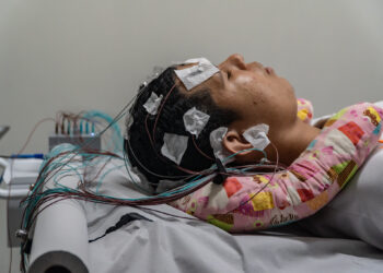 Bertioga adquire novo equipamento de eletroencefalograma e amplia serviços da Unibem