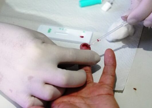 ‘Dia D’ atende 182 pessoas com testes rápidos e UAMI continua com a Campanha Dezembro Vermelho