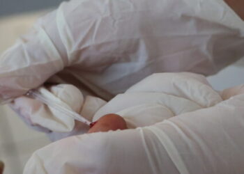 Centro Pop recebe ação conjunta de testagem para Hepatite C em Caraguatatuba