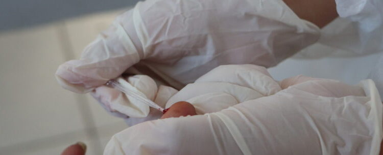 Centro Pop recebe ação conjunta de testagem para Hepatite C em Caraguatatuba