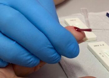 Caraguatatuba realiza testagem gratuita para hepatites virais em ações do Julho Amarelo